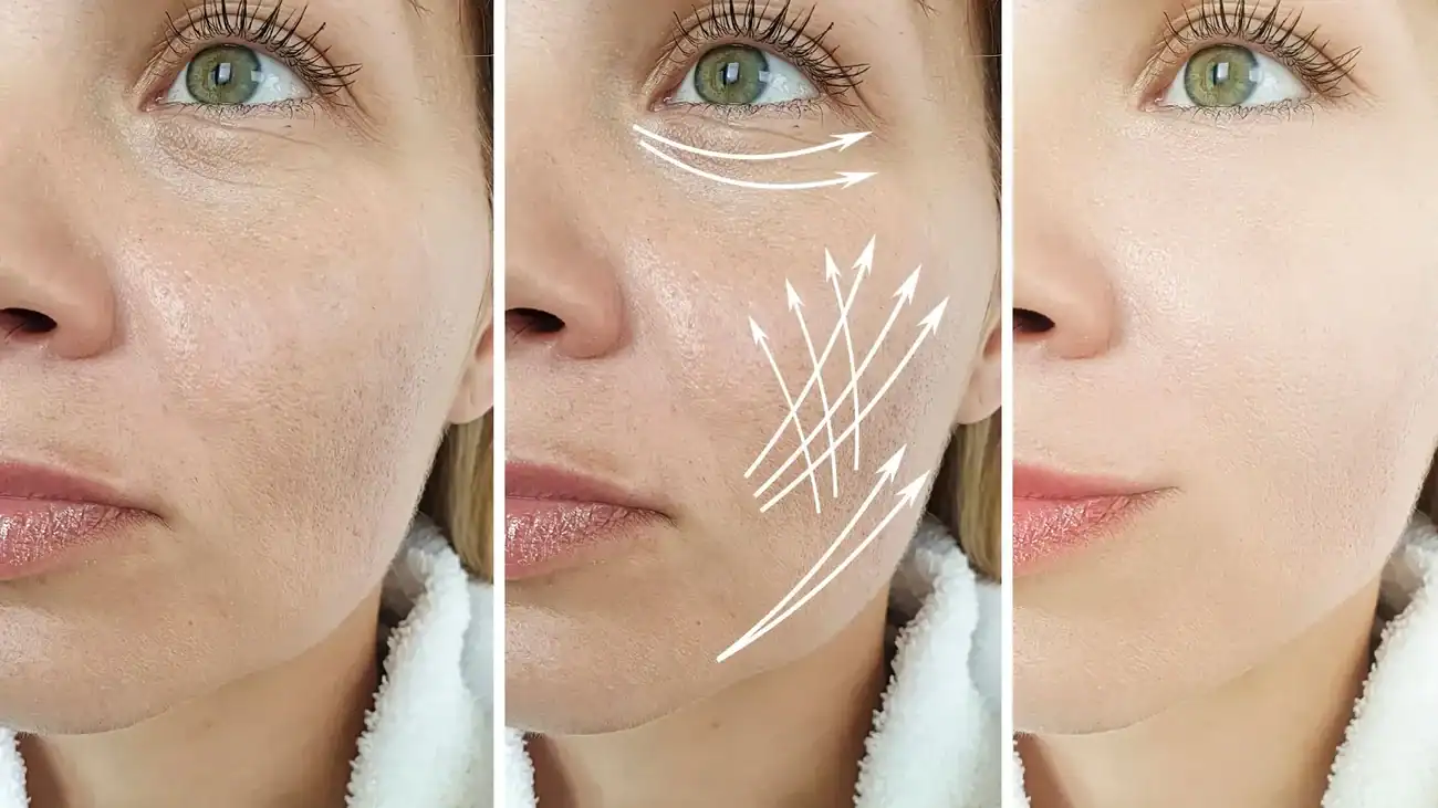 Can One Treatment Really Tackle More Than One Skin Concern Brackley?